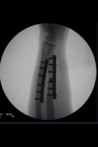 425288_10150535392766783_575661782_9178042_1690473916_n